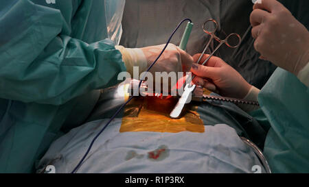 Suture of an lung emphysema surgery in an infant, medical assistance close-up Stock Photo