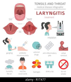 Tonsils and throat diseases. Laryngitis symptoms, treatment icon set. Medical infographic design. Vector illustration Stock Vector