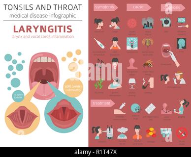 Tonsils and throat diseases. Laryngitis symptoms, treatment icon set. Medical infographic design. Vector illustration Stock Vector