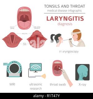 Tonsils and throat diseases. Laryngitis symptoms, treatment icon set. Medical infographic design. Vector illustration Stock Vector