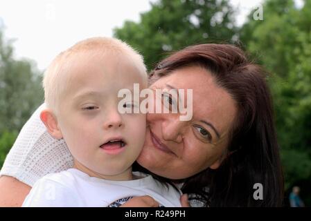 Defect,childcare,medicine and people concept- happy mother and son with down syndrome. Stock Photo