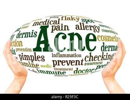 Acne word cloud hand sphere concept on white background. Stock Photo