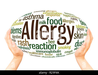 Food allergy word cloud concept Stock Photo - Alamy