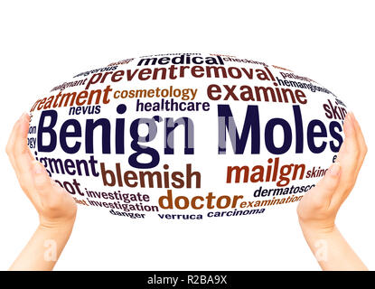 Benign Moles word cloud hand sphere concept on white background. Stock Photo