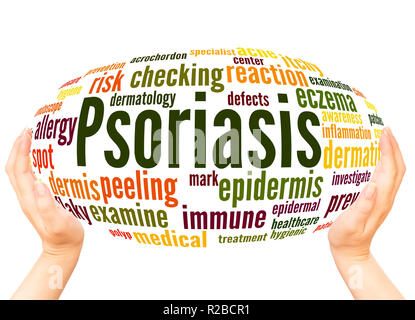 Psoriasis word cloud hand sphere concept on white background. Stock Photo