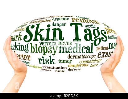 Skin Tags word cloud hand sphere concept on white background. Stock Photo