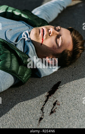 close-up view of injured young man on road after traffic accident Stock Photo
