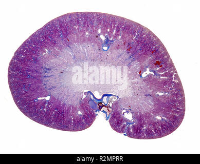 Longitudinal section of a kidney Stock Photo - Alamy