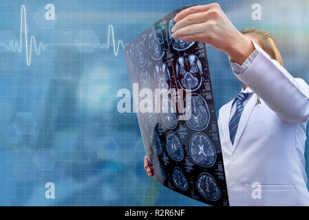 woman doctor holding CT scan film for diagnosis problem in brain Stock Photo