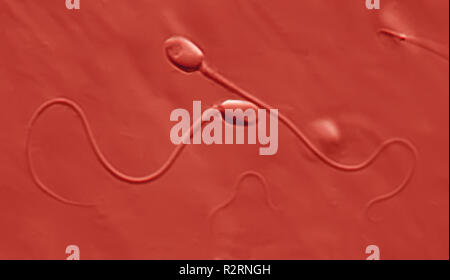 spermatozoa spermatozoa spermien ejaculation sperms ejakulation ...