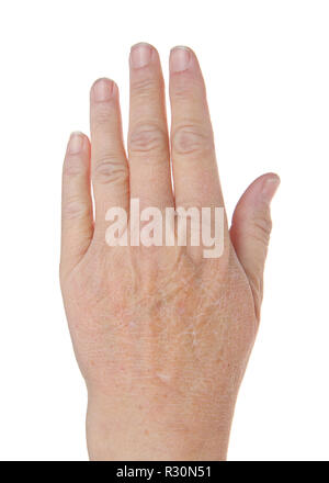 fingers alamy caucasian