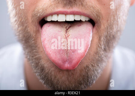 Close-up Of A Man Showing His Tongue Stock Photo