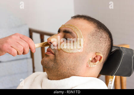 Hair removal. Man s face sugaring epilations in Turkey Stock Photo