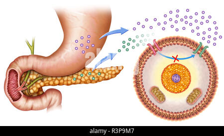 Illustration of insulin and glucose production in Type 2 diabetes ...