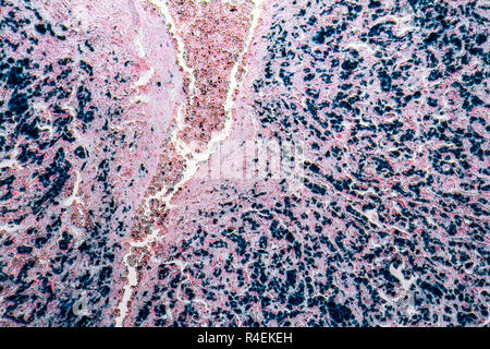 human liver micrography Stock Photo
