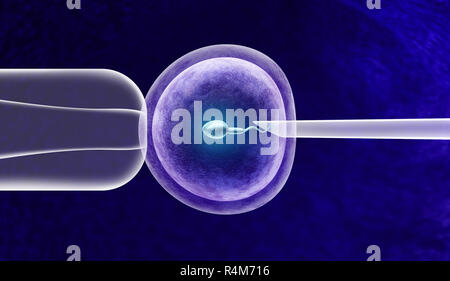 In vitro fertilization or IVF fertility treatment and artificial insemination with a human egg cell and sperm helping with infertility issues. Stock Photo