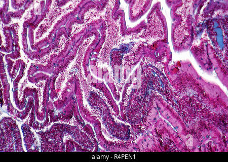 duodenum cross section Stock Photo