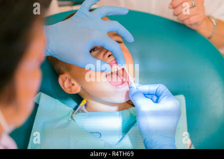 Dentist is treating a boy's teeth. A small patient in the dental chair smiles. Dantist treats teeth. close up view of dentist treating teeth of little Stock Photo