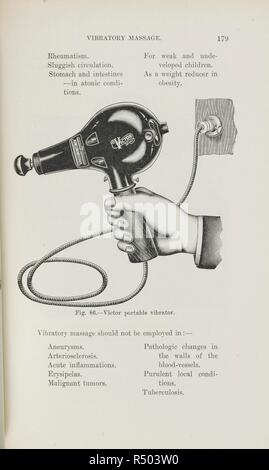An illustration of a hand held vibrating massage machine, a 'Victor  portable vibrator', used for medical conditions. Hand-Book of  Electro-Therapeutics ... With ninety-one illustrations. Philadelphia, 1910.  Source: 8754.c.5 page 179. Language: English