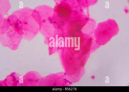 Multiple squamous epithelium under the microscope - Abstract pink dots on white background Stock Photo