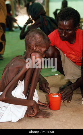 1993 - A Somali refugee child is fed at an aid station set up during Operation Restore Hope relief efforts. (Bardera Somalia)