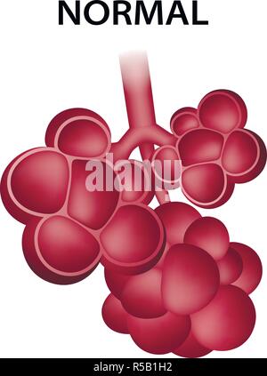 the usual loss of alveoli is minimal in a healthy individual, so the anatomic dead space is?