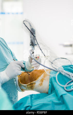 Knee arthroscopy, France. Stock Photo