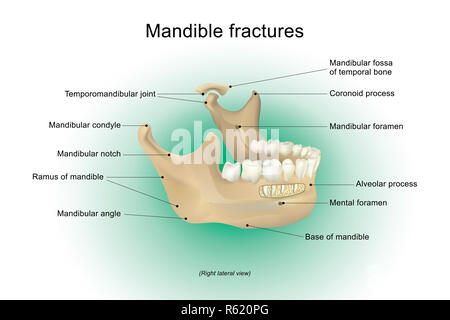 Anatomy of mandible fractures. Stock Photo