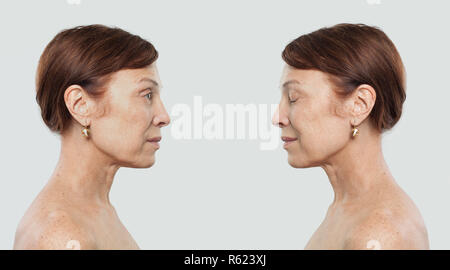 Mature woman portrait. Facial treatment, cosmetology, aesthetic medicine and plastic surgery concept Stock Photo