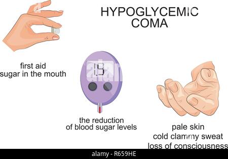 illustration of symptoms and hypoglycemic coma. infographics Stock Vector