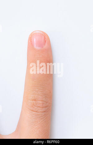 Hand skin care Stock Photo