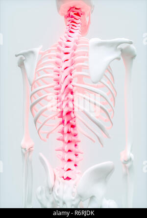 Aching Spine - upper limb bone - 3d rendering Stock Photo