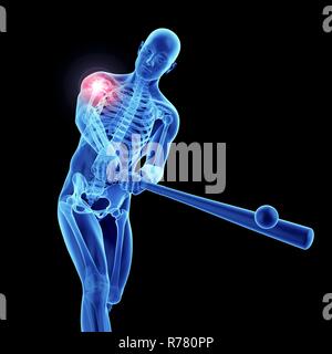 3d rendered illustration of an athlete's painful shoulder. Stock Photo