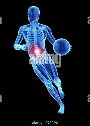 3d rendered illustration of an athlete's painful spine Stock Photo - Alamy