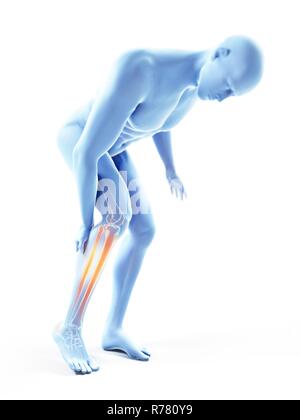 3d rendered medical illustration - painful spine Stock Photo - Alamy