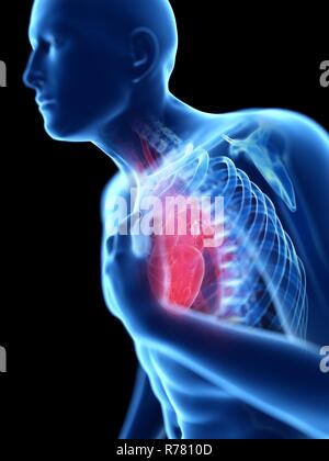 3d rendered illustration of a man with chest pain. Stock Photo