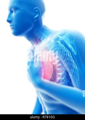 3d rendered illustration of a man with chest pain. Stock Photo