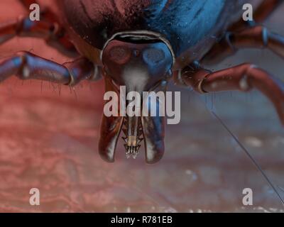 3d rendered illustration of a tick on human skin. Stock Photo