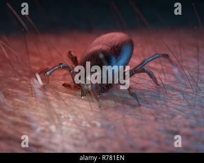 3d rendered illustration of a tick on human skin. Stock Photo