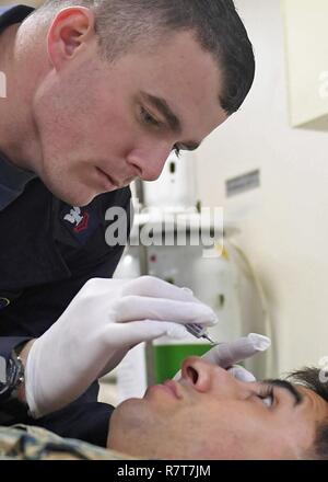 SAN DIEGO (April 6, 2017) A patient has his eyes checked after ...