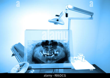 photo of full mouth dental xray(x-ray), blue tone Stock Photo