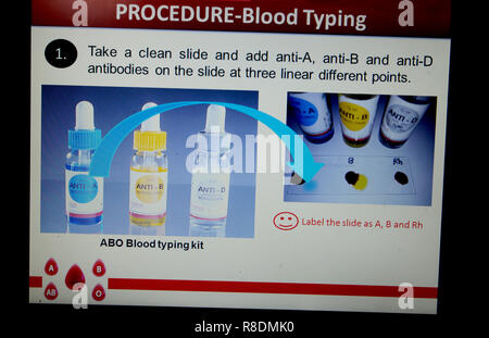 Procedure - Blood typing Stock Photo