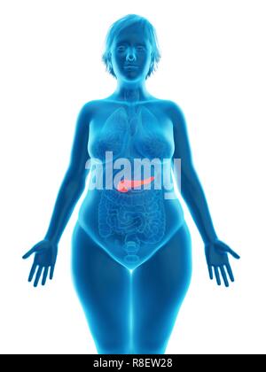 Illustration of an obese woman's pancreas. Stock Photo