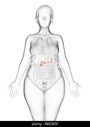 Illustration of an obese woman's pancreas. Stock Photo