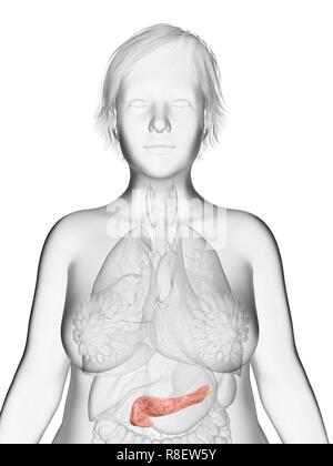 Illustration of an obese woman's pancreas. Stock Photo