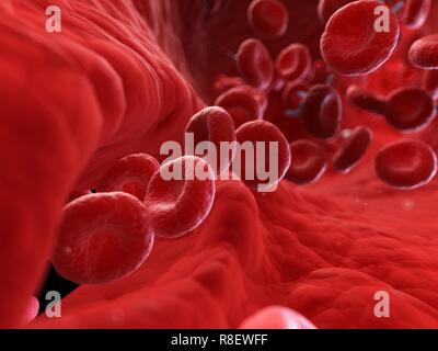 Illustration of an injured artery. Stock Photo