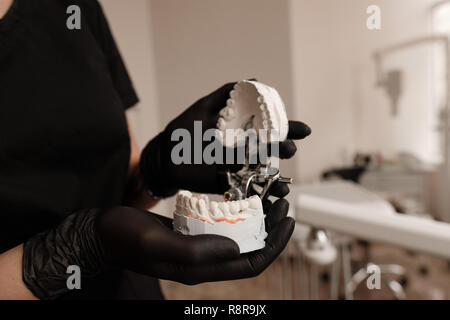 Plaster Cast of jaws. Dentist in black gloves holding Dental casting gypsum model human Jaws in prosthetic laboratory. Dentistry, Orthodontics. Close  Stock Photo