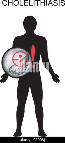 illustration of gallstone disease. pain and symptoms Stock Vector