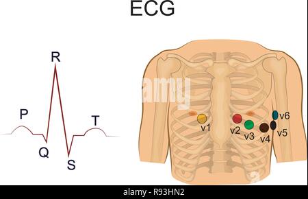 vector illustration of electrocardiogram. Chest leads. cardiology Stock Vector