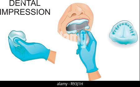 vector illustration of a dental cast of human teeth Stock Vector